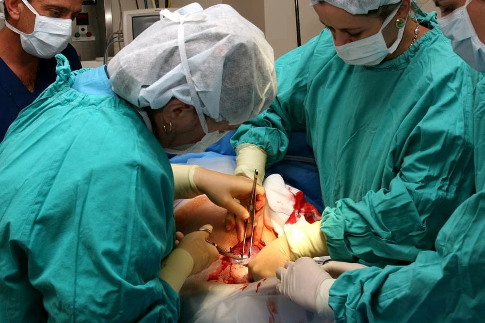Reasons for a Cesarean Birth