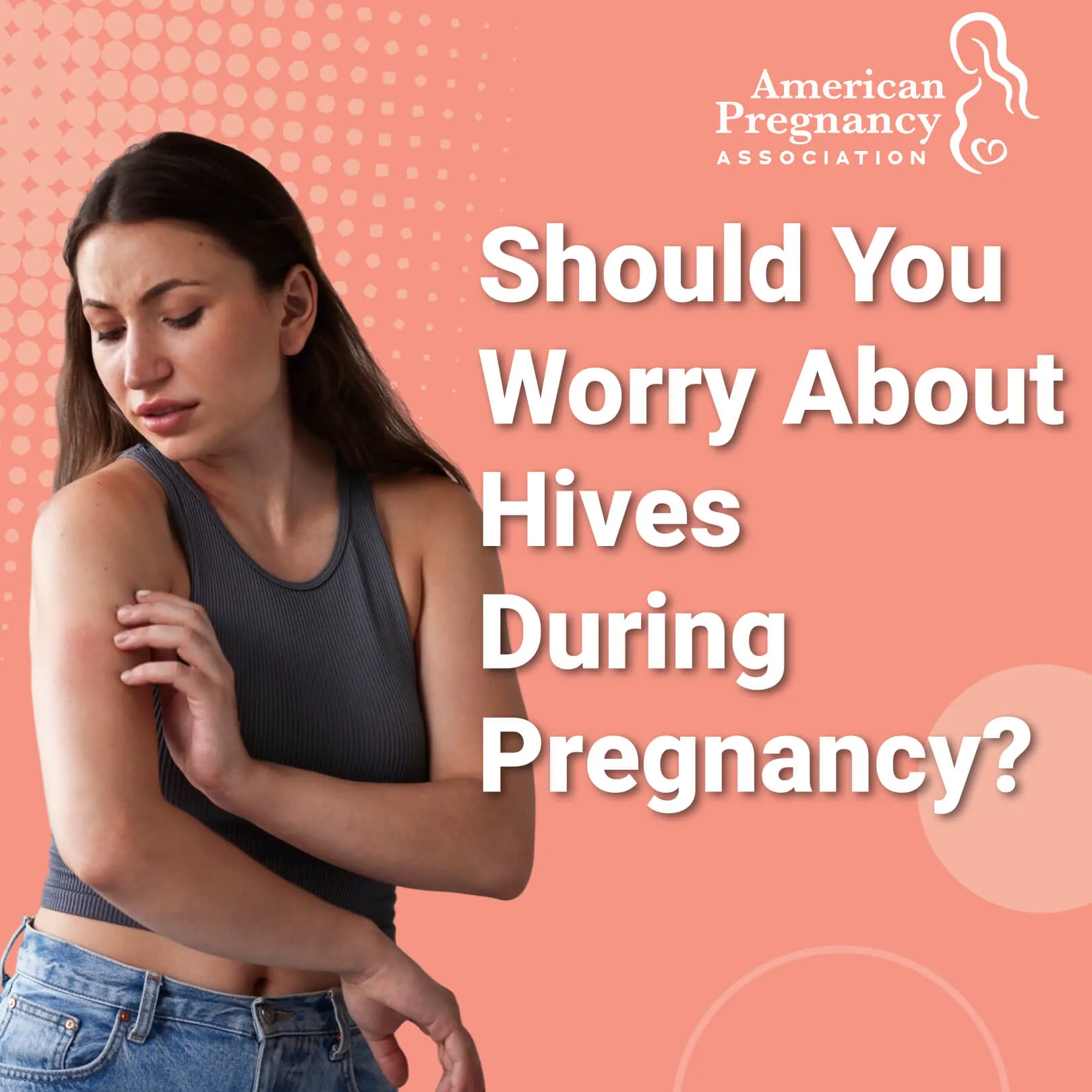 Should You Worry About Hives During Pregnancy